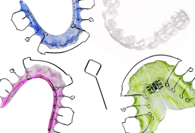 retainers retention