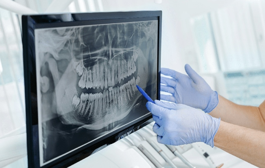 x-ray-oral-surgery oral surgery